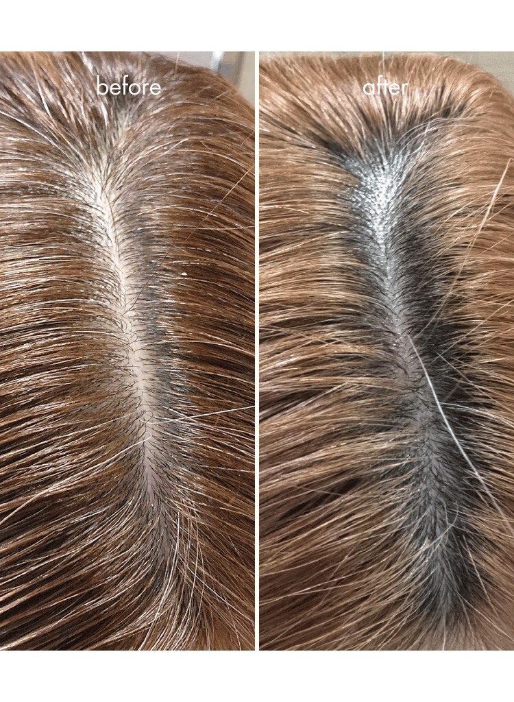 IHAIR Hair Densifying Serum