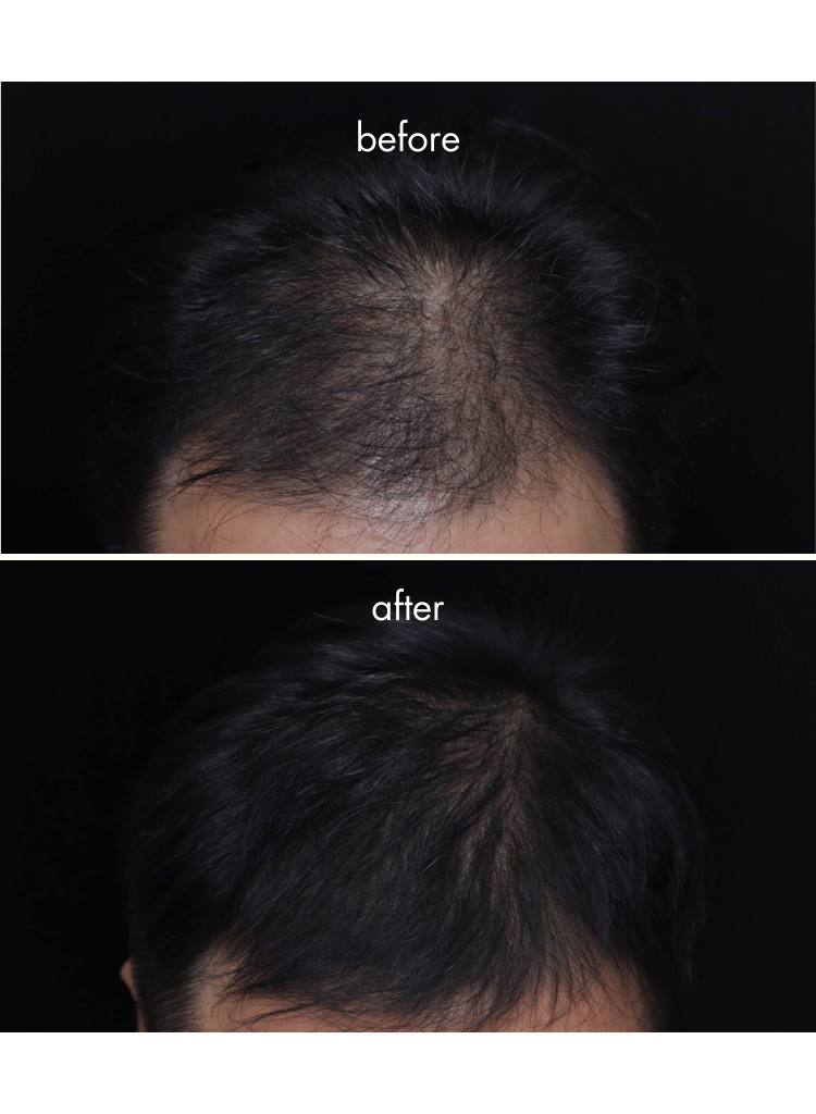 IHAIR-Hair_Densifying_Serum_4_bf091d59-6bcc-44e2-9c16-f71a18411cd8.png